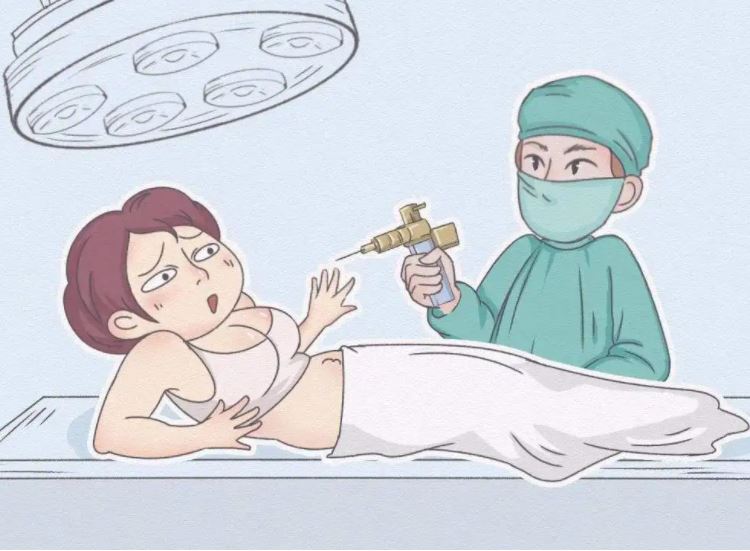 全身抽脂對(duì)身體有什么傷害？