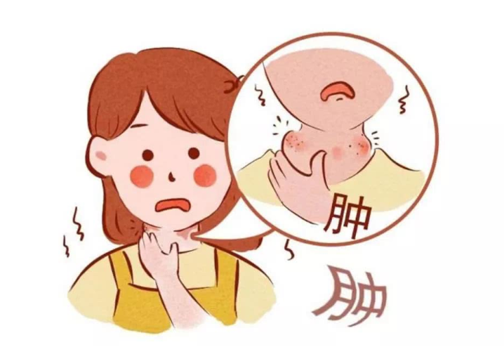 扁桃體發(fā)炎吃什么藥好得快？扁桃體發(fā)炎飲食禁忌有哪些？